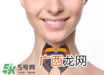 甲亢是怎么引起的？甲亢的早期症状