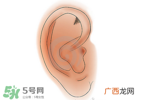 中耳炎有什么症状？中耳炎的症状表现
