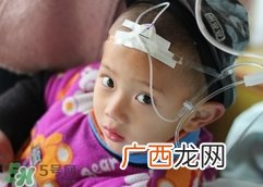 猩红热要打几天吊针?猩红热要打几天点滴?