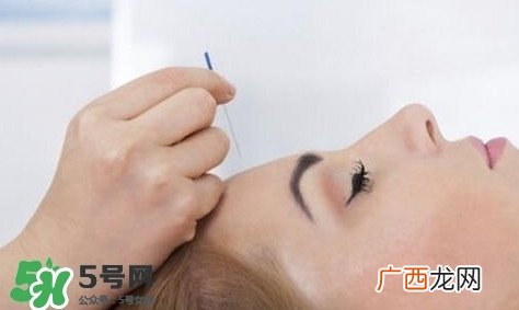 丛集性头痛会死人吗?丛集性头痛的特点