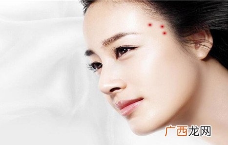 太阳穴长痘怎么回事？为什么太阳穴附近会长痘