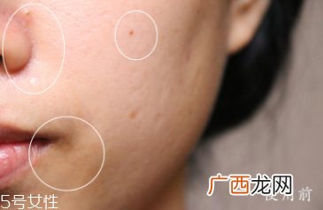 悦木之源和伊丽莎白雅顿哪个好？两款精华大比拼