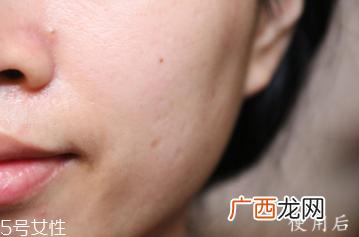 悦木之源和伊丽莎白雅顿哪个好？两款精华大比拼