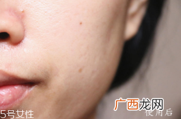 悦木之源和伊丽莎白雅顿哪个好？两款精华大比拼