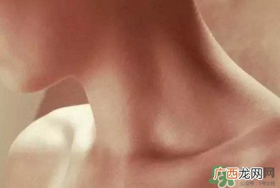 颈椎老化是什么病？颈椎老化的症状