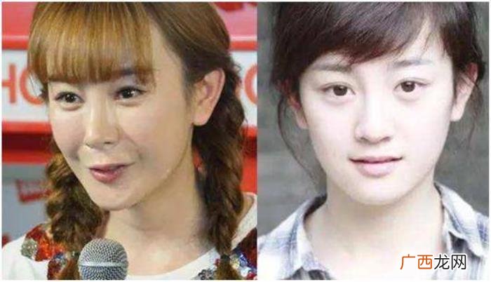 整过容的明星有哪些，盘点那些整过容的明星
