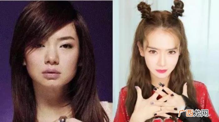 整过容的明星有哪些，盘点那些整过容的明星