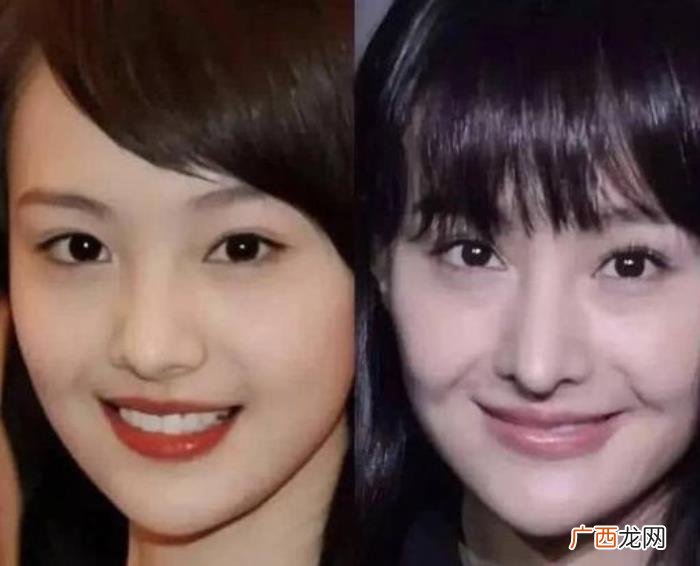 整过容的明星有哪些，盘点那些整过容的明星