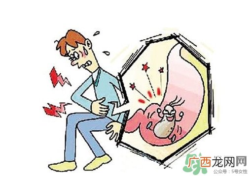胃癌如何确诊？胃癌如何检查出来的