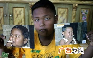 男童2岁时日抽40支烟吸烟的危害有哪些
