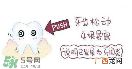 牙齿松动能自己恢复吗？牙齿松动会自己恢复吗