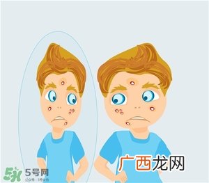 得了痤疮饮食注意什么?有痤疮吃东西注意什么