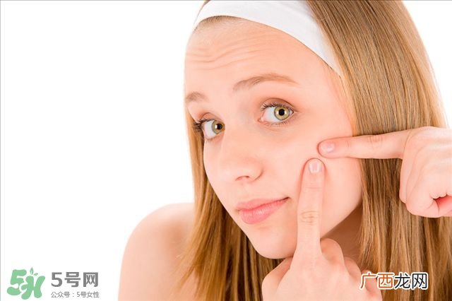 得了痤疮饮食注意什么?有痤疮吃东西注意什么