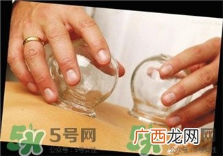 怎么判断自己湿气重不重?湿气重的表现