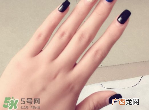 手心出汗怎么治疗?手心出汗怎么办?