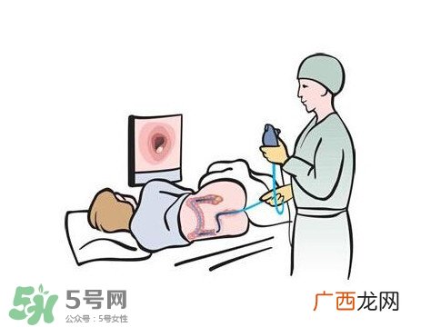 直肠癌怎么查出来的？直肠癌怎么判断早晚期