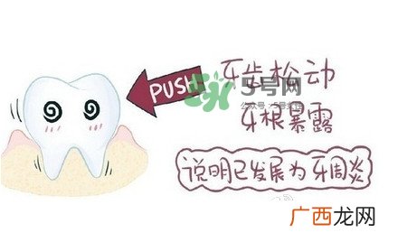 牙齿松动会自己好吗？牙齿松动会自己掉吗