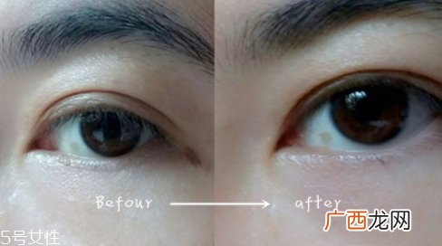 雅诗兰黛舒缓眼膜使用方法