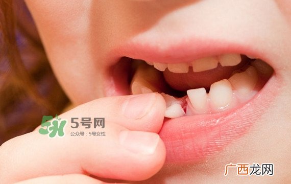 牙齿松动可以重新长牢固吗？牙齿松动可以修复吗