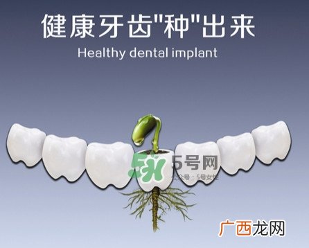 种植牙费用多少钱？国产种植牙价格