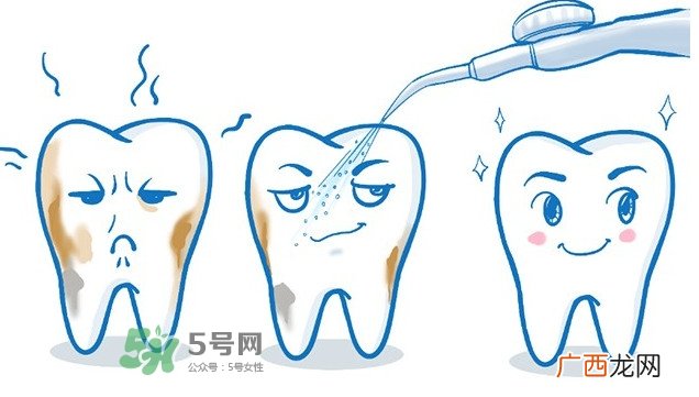 洗牙多少钱一次洗牙多久洗一次比较好