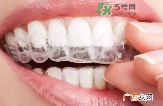 牙齿有缝隙可以补吗？牙齿缝隙大能补吗