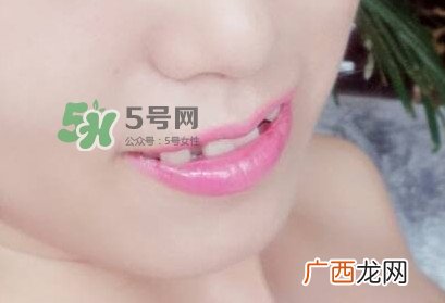 牙齿缝隙大怎么办？牙缝大带牙套有用吗