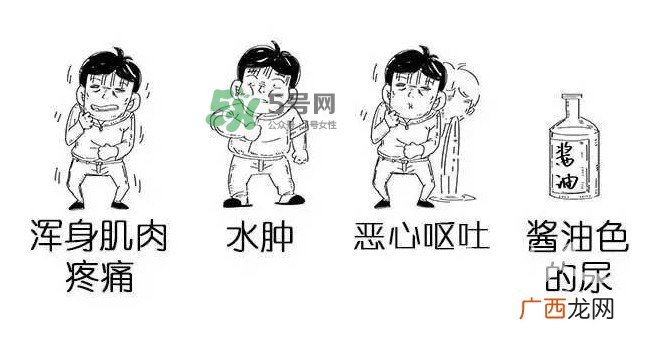 吃小龙虾什么会得横纹肌溶解症？横纹肌溶解症严重吗