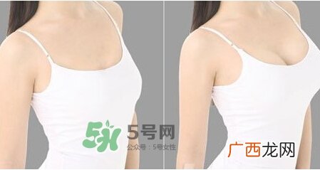 女性乳头痒是怎么回事？女性乳头痒要怎么治疗？