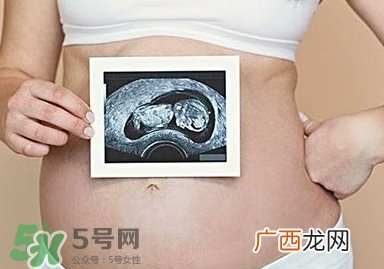 双子宫可以上环吗?双子宫上环要注意哪些?