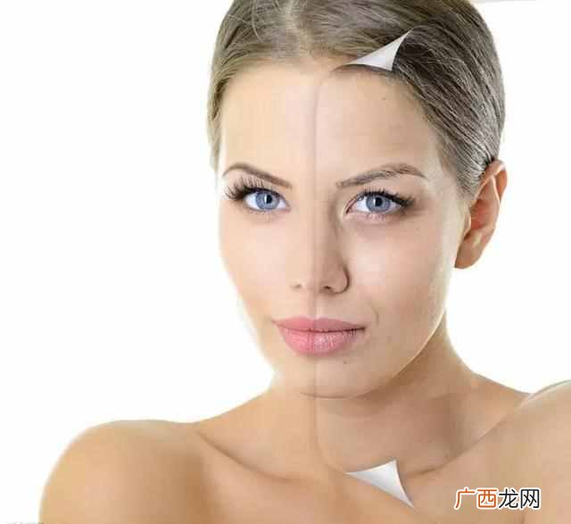 枸杞有什么营养价值 什么人吃枸杞好