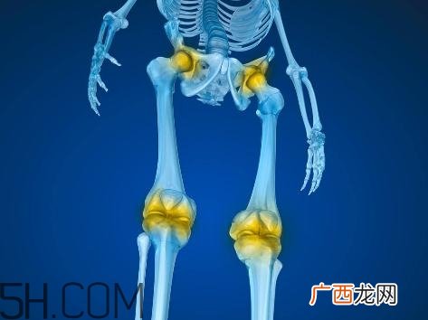 关节炎积液什么症状？关节炎积水怎么治疗？