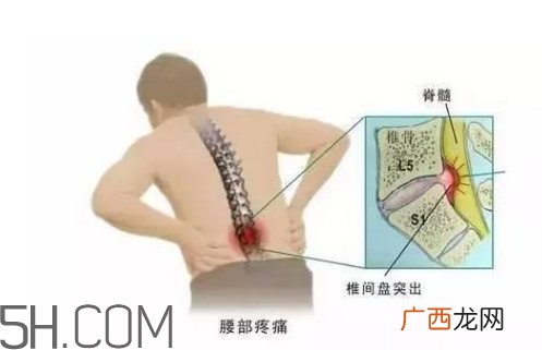 腰间盘突出是什么原因引起的？腰间盘突出是肾虚吗