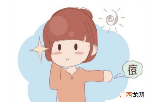 出水痘可以晒太阳吗水痘患者的保养