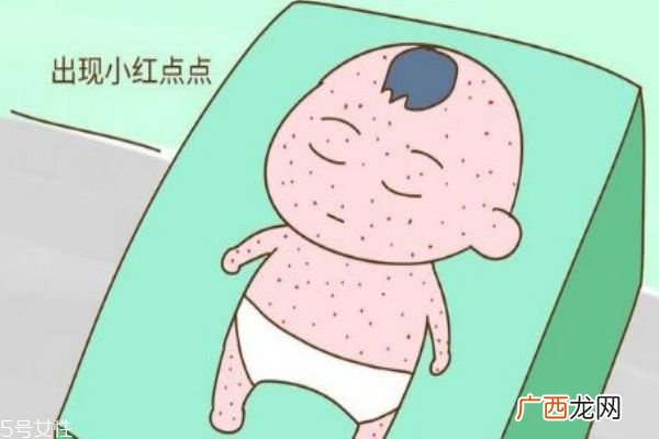 幼儿急疹和麻疹区别3步看出宝宝是否是麻疹