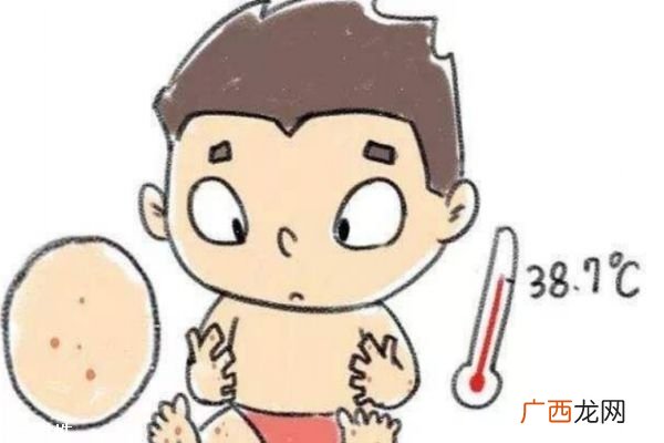 什么是手足口病为什么会得手足口病