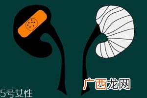 肾病为什么会发展到尿毒症?这些因素一定要注意