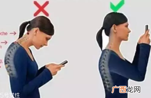 脖子有声响是什么病？可能是关节炎