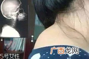 富贵包是什么病？姿态优美少犯病