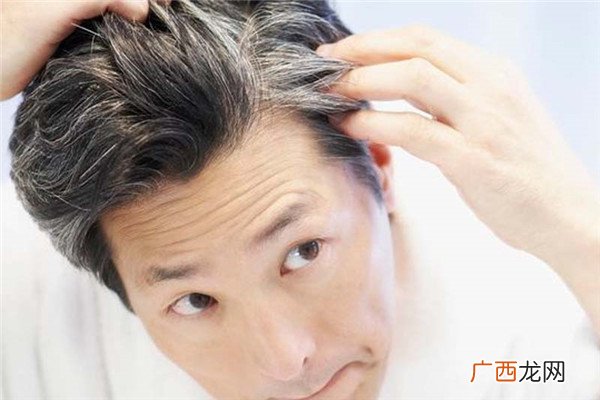 头发白是什么原因引起的不能治愈的白发病