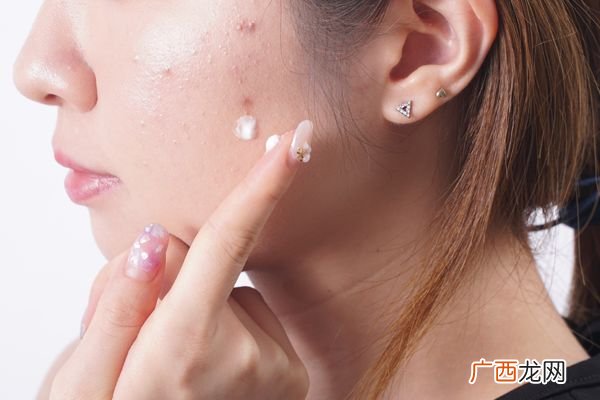 暗疮怎么能快速消肿内服外用消灭暗疮