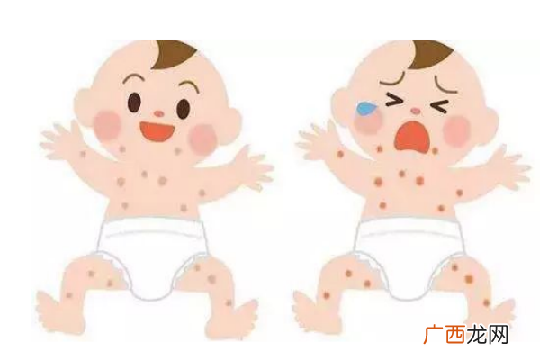 宝宝湿疹怎么办生活上要注意