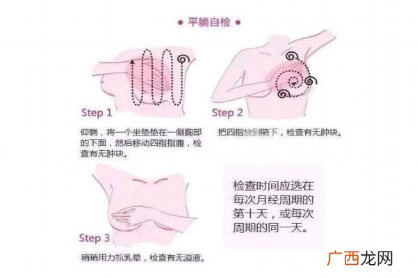 乳腺癌会遗传吗诱发乳腺癌的原因