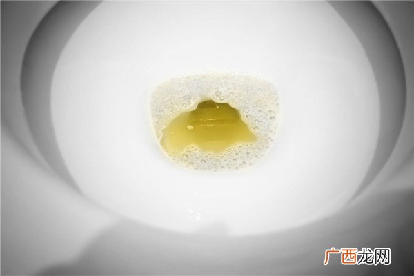 尿液有泡沫正常吗三种尿液情况要重视