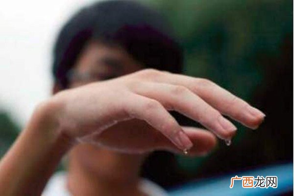 多汗症是什么多汗症出汗程度怎么分级的