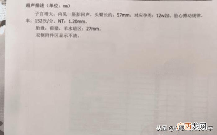 生女孩的症状,十有八九怀的是女孩儿