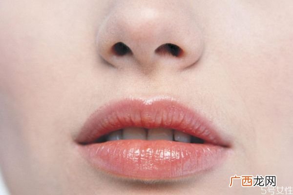 唇炎一般是怎么造成的呢唇炎的种类有什么呢