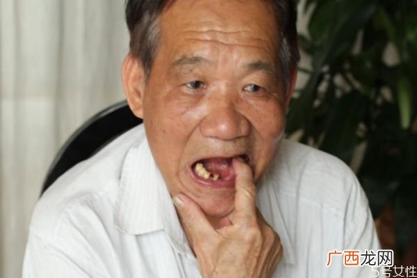 牙齿松动可以吃冰糖葫芦吗牙齿松动不能吃什么呢