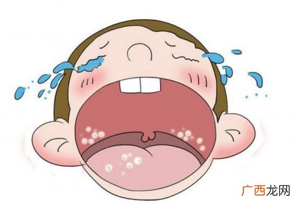 什么是鹅口疮鹅口疮危害大吗