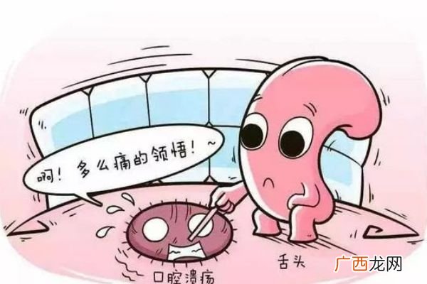 口腔溃疡多长时间自愈口腔溃疡吃什么水果